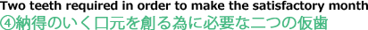 ④納得のいく口元を創る為に必要な二つの仮歯